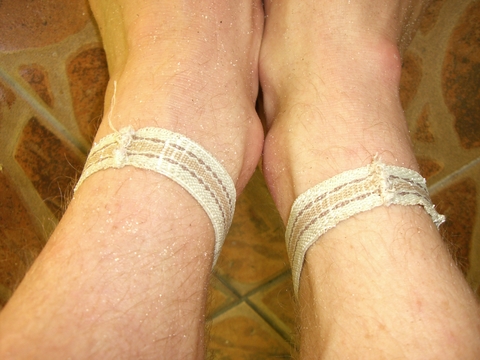 mosquito-bands.jpg