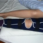 dodgy knee